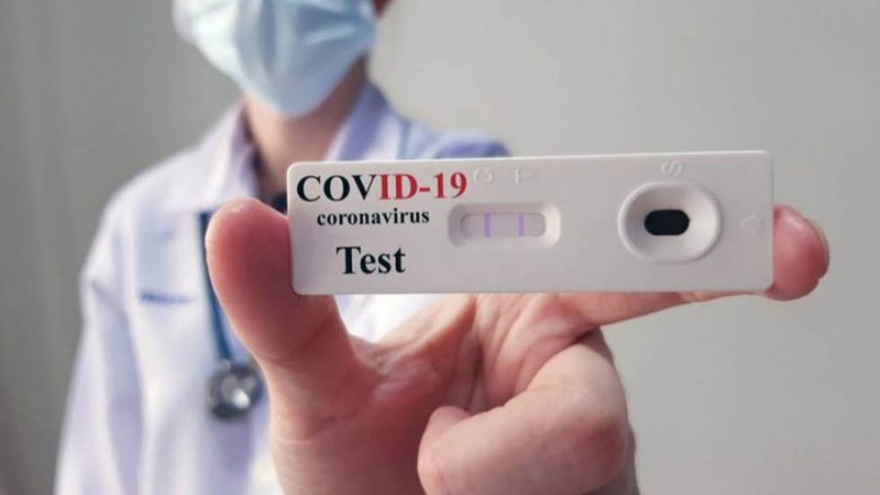 Los «autotest» de Covid estarían disponibles la semana que viene en farmacias por 1.560 pesos