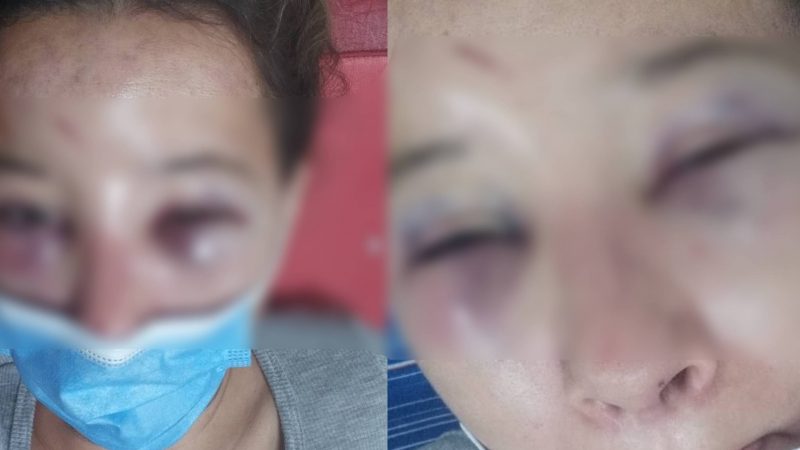 Sáenz Peña desenfrenada: golpean a una joven, a la salida de un boliche