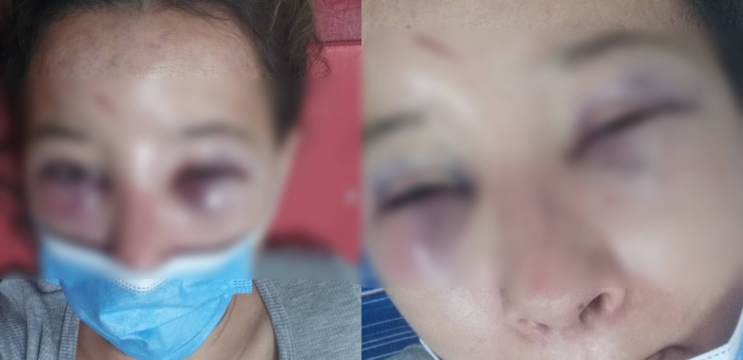 Sáenz Peña desenfrenada: golpean a una joven, a la salida de un boliche