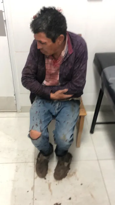 Gral. San Martin: Lo mató por negarle un cigarrillo