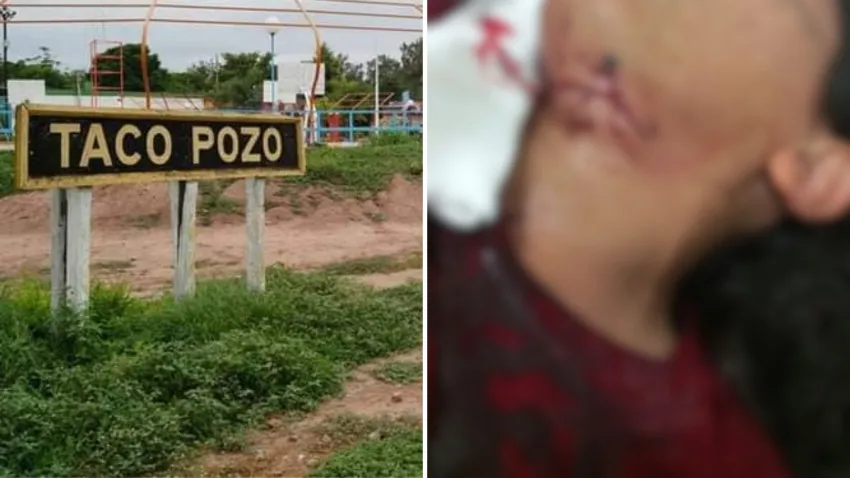 Tentativa de femicidio en Taco Pozo: un hombre le cortó el cuello a su expareja